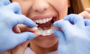 Kiedy zaprowadzić dziecko na pierwszą wizytę do ortodonty?