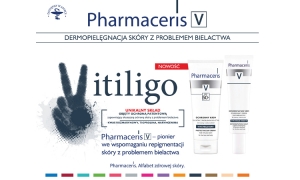 Co to jest vitiligo?
