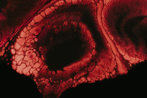 blefaroplastyka