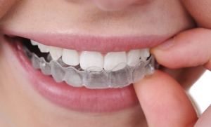Czy leczenie ortodontyczne boli ?