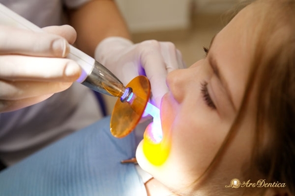 Piaskowanie zębów – zabieg stomatologiczny