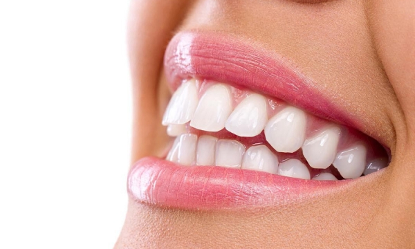 Zdrowe i piękne zęby. Jakie są koszty leczenia metodą lingwalną?
